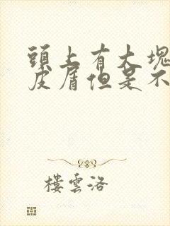 头上有大块的头皮屑但是不痒