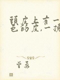 头皮上有一层白色的皮,一挠就变成了头皮屑封面