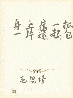 身上痒一抓就红一片还起包怎么办