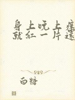 身上晚上痒一抓就红一片还凸起怎么办