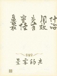 鼻窦炎用什么药最佳有效治疗