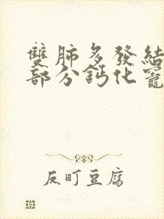 双肺多发结节,部分钙化灶