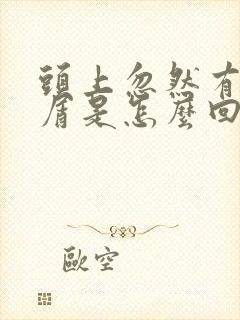 头上忽然有头皮屑是怎么回事