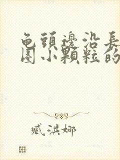 龟头边沿长了一圈小颗粒的东西是什么