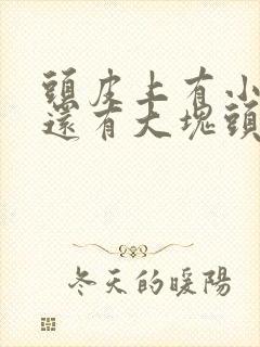 头皮上有小红点还有大块头屑