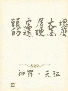 头皮屑大块大块的还硬怎么回事