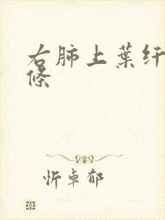 右肺上叶纤维索条