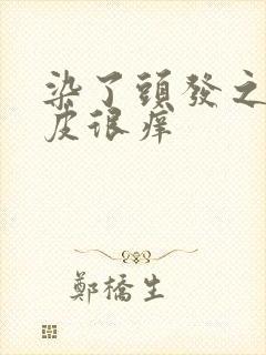 染了头发之后头皮很痒