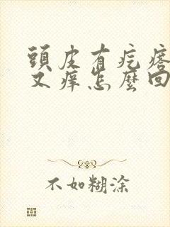 头皮有疙瘩又疼又痒怎么回事