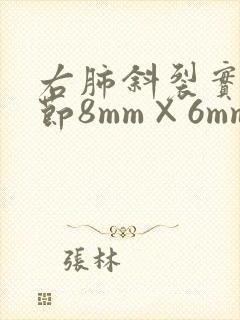 右肺斜裂实性结节8mm×6mm封面