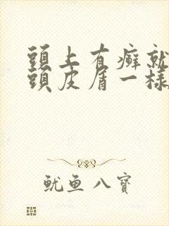 头上有癣就好像头皮屑一样