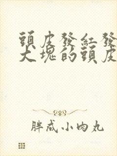 头皮发红发痒有大块的头皮屑是怎么回事