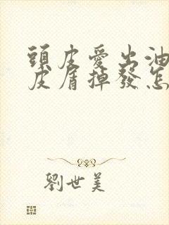 头皮爱出油有头皮屑掉发怎么办