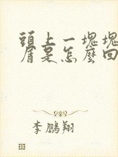 头上一块块头皮屑是怎么回事