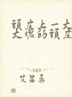 头皮上一大块一大块的头皮屑