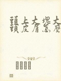 头上大块大块的头皮屑怎么去除