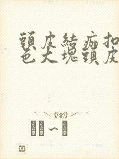 头皮结痂扣下白色大块头皮屑