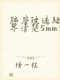 肺磨玻璃结节边界清楚5mm要不要紧