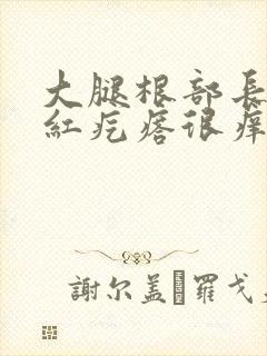 大腿根部长了小红疙瘩很痒