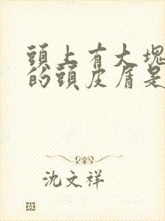 头上有大块成片的头皮屑是怎么回事