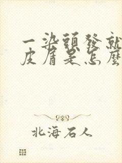 一染头发就有头皮屑是怎么回事