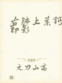 右肺上叶钙化结节影