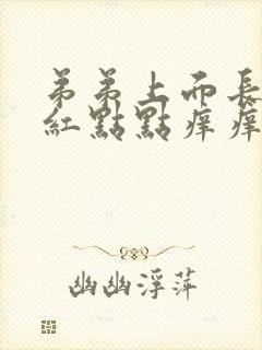 弟弟上面长好多红点点痒痒的封面