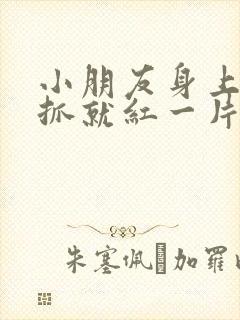 小朋友身上痒一抓就红一片还凸起