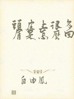 头皮上很多头皮屑是怎么回事