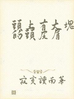 头上有大块大块的头皮屑