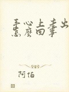 手心上老出汗是怎么回事封面