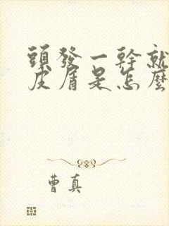 头发一干就有头皮屑是怎么回事封面