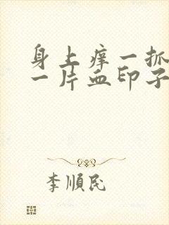 身上痒一抓就红一片血印子