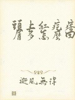 头上红疙瘩头皮屑多怎么回事