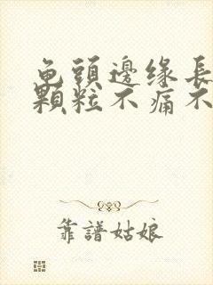 龟头边缘长了小颗粒不痛不痒封面