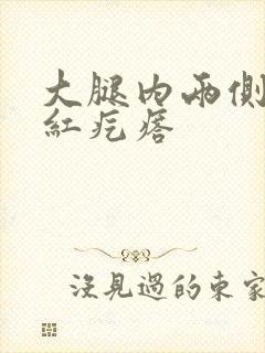 大腿内两侧瘙痒红疙瘩