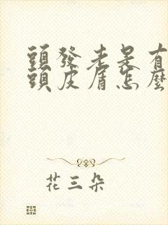 头发老是有很多头皮屑怎么回事