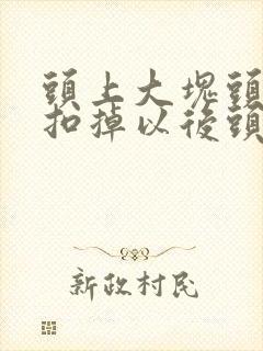 头上大块头皮屑扣掉以后头皮发红封面