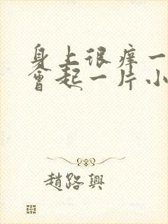 身上很痒一挠就会起一片小疙瘩