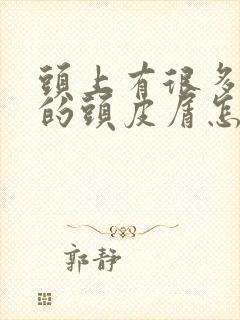 头上有很多大块的头皮屑怎么回事