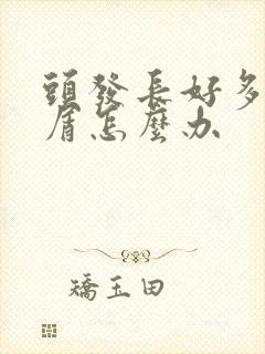 头发长好多头皮屑怎么办