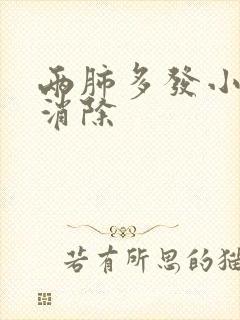 两肺多发小结节消除