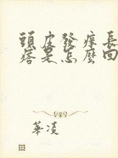 头皮发痒长红疙瘩是怎么回事