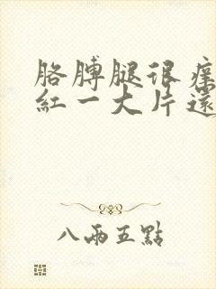 胳膊腿很痒一挠红一大片还有小疙瘩