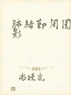 肺结节周围条索影