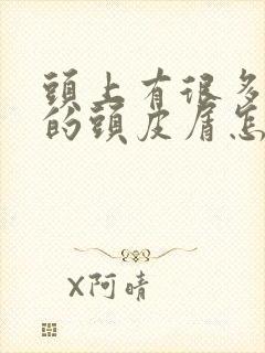 头上有很多大块的头皮屑怎么回事