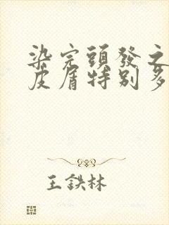 染完头发之后头皮屑特别多