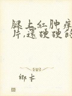 腿上红肿痒一大片,还硬硬的封面