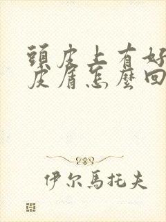 头皮上有好多头皮屑怎么回事