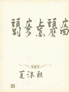 头皮上头皮屑特别多怎么回事